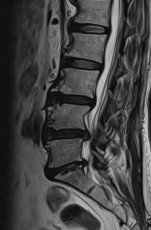61 patient back pain 01