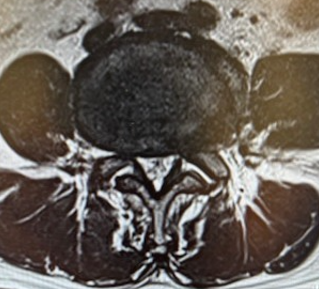 61 patient back pain 02