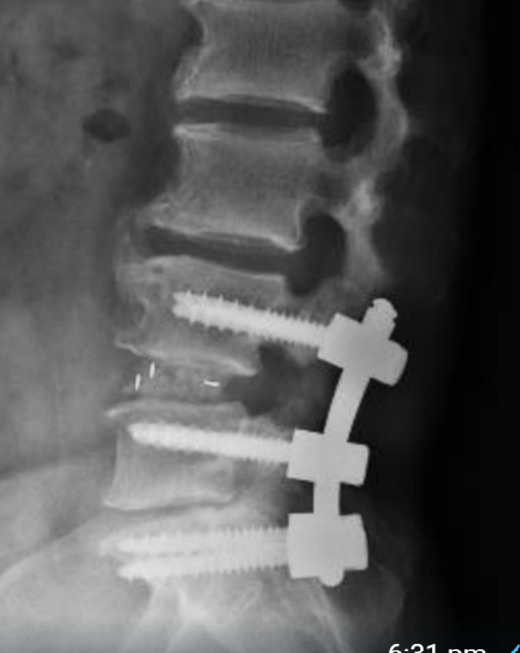61 patient back pain 03