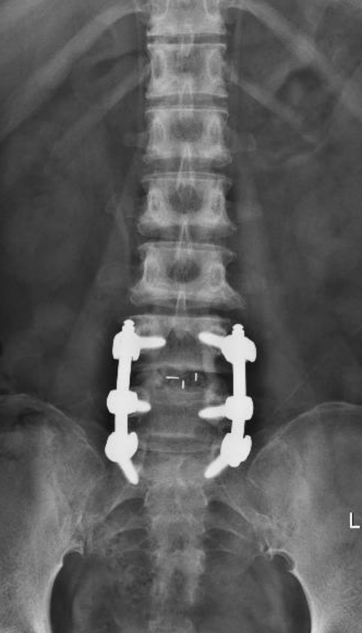 61 patient back pain 04
